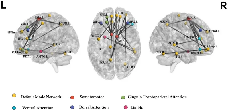 Brain connectivity networks showing default mode, executive, and salience networks