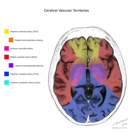 Brain vascular territories showing anterior, middle, and posterior cerebral artery distributions