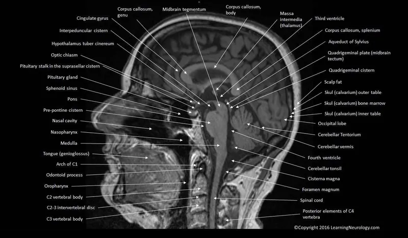 Detailed sagittal brain MRI showing major anatomical structures and divisions
