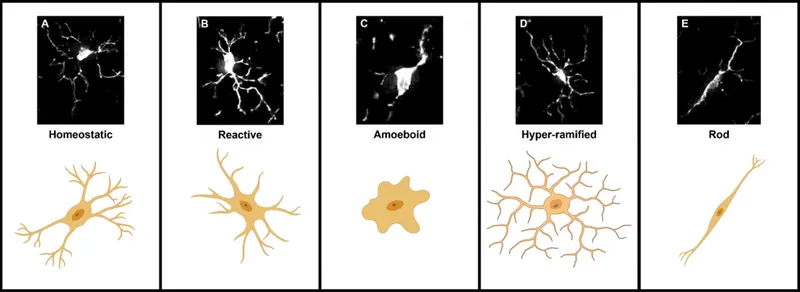 Microglial activation states showing morphological changes from resting to activated