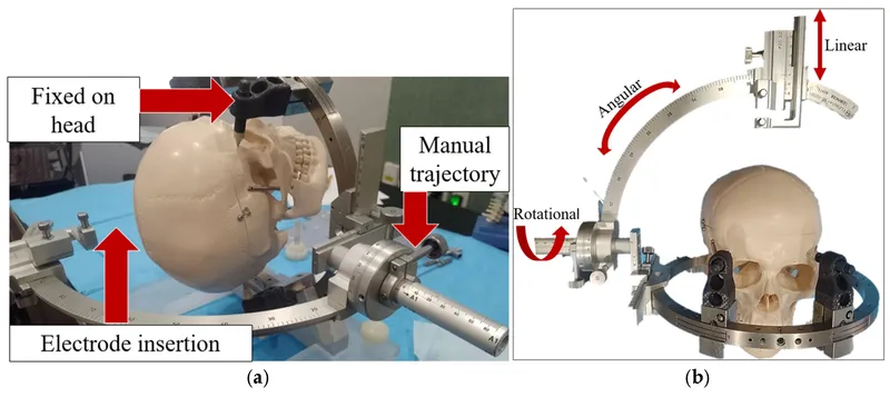 Stereotactic frame setup showing coordinate system and targeting