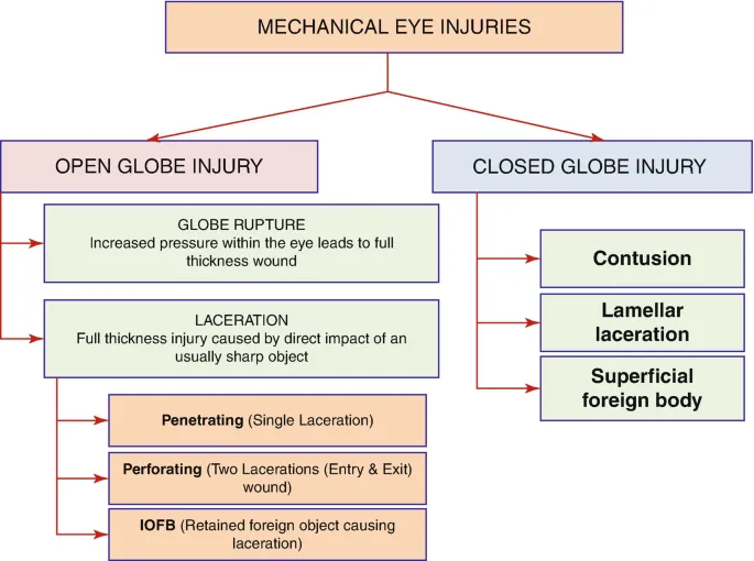 Comprehensive diagram showing different types of ocular trauma with anatomical cross-sections