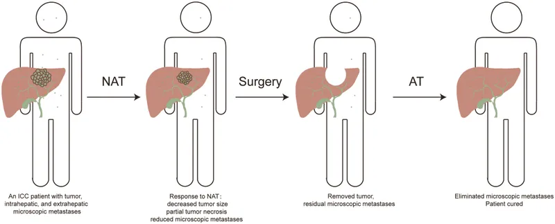 Timeline showing neoadjuvant therapy followed by surgery and adjuvant treatment