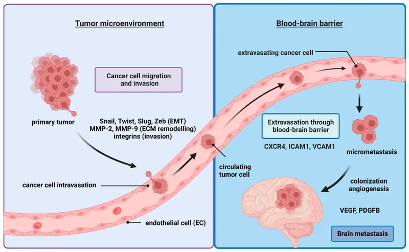 Diagram showing the metastatic cascade from primary tumor to distant colonization