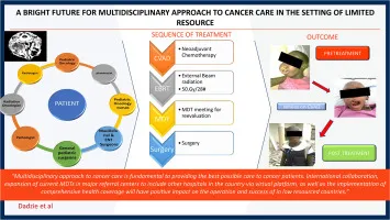 Multidisciplinary cancer care team coordination diagram