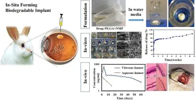 Cross-sectional diagram of sustained-release drug delivery implant in eye
