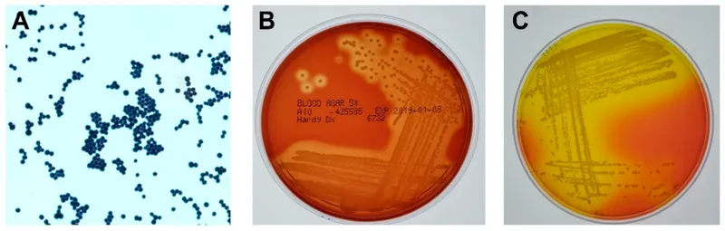 Bacterial culture showing Staphylococcus aureus colonies from orbital abscess specimen