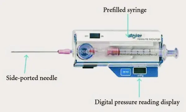 Compartment pressure measurement technique with needle manometer