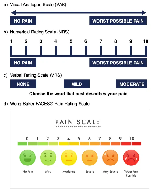 Figure 1: Visual analogue scale showing 100mm horizontal line with 'No pain' at left end and 'Worst pain imaginable' at right end