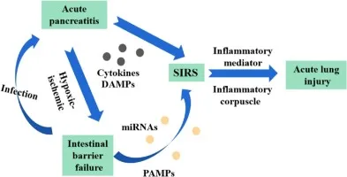 Systemic inflammatory response diagram showing multi-organ effects of severe pancreatitis