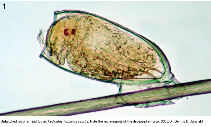 Microscopic view of various skin parasites including scabies mites, lice, and larval forms