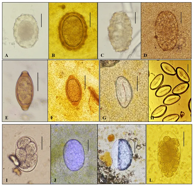 Morphological comparison chart of similar parasitic organisms