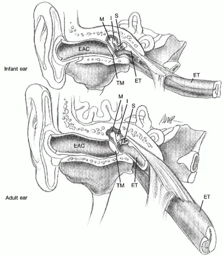Eustachian tube angle development from infant to adult