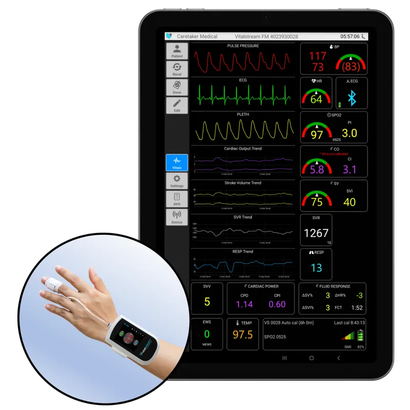 Post-operative monitoring setup with multiple vital sign displays