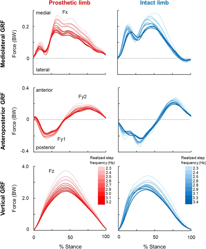 Biomechanical analysis of prosthetic gait showing force vectors and moments
