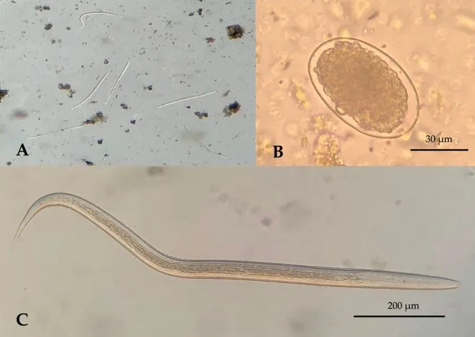 Microscopic images showing parasitic identification features in blood and stool specimens