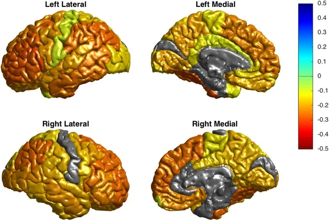 Comparison of brain structure changes in different psychotic disorders