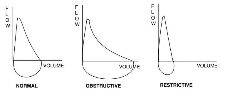 Spirometry flow-volume loops comparing normal, obstructive, and restrictive patterns