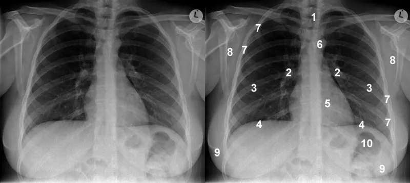 Systematic approach to radiologic landmark identification with step-by-step methodology