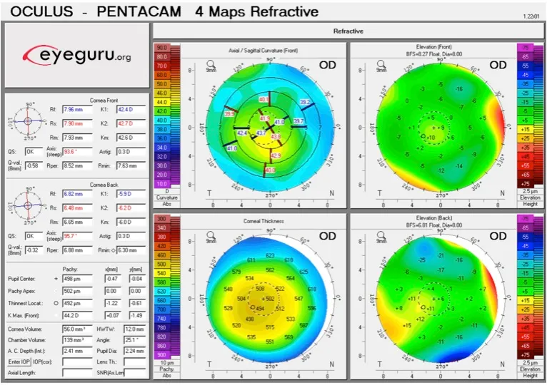 Comprehensive preoperative examination setup for refractive surgery candidacy