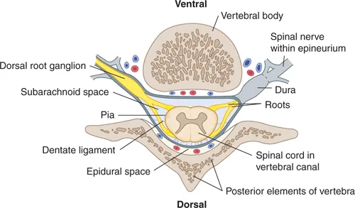 Anatomical cross-section showing spinal cord, epidural space, and surrounding structures