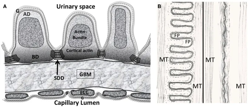 Electron microscopy of glomerular filtration barrier showing podocyte foot processes
