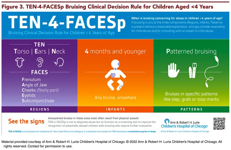 Figure 2: Clinical photograph showing patterned bruising consistent with belt marks on child's back