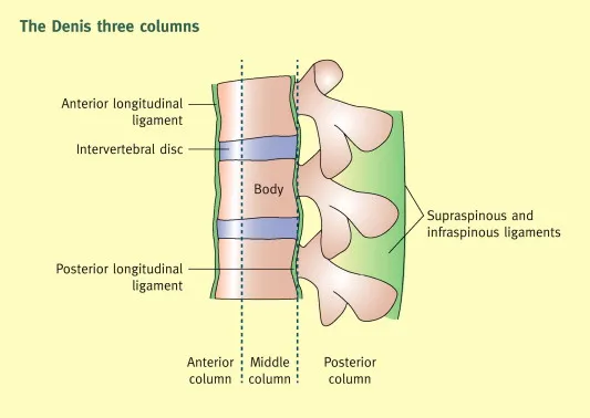Cross-sectional anatomy showing Denis three-column spinal stability model