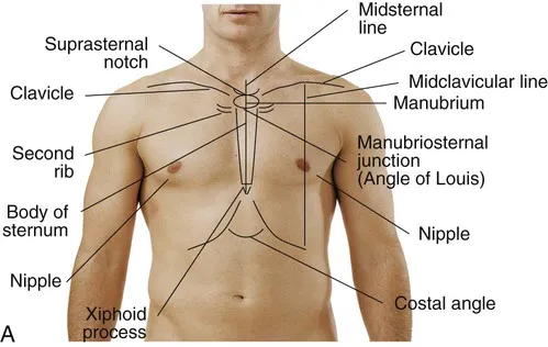 Anatomical diagram showing differential diagnosis landmarks for chest pain