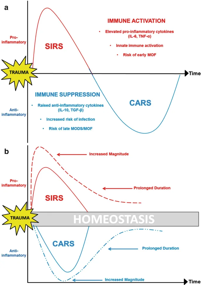 Inflammatory cascade diagram showing SIRS and CARS phases