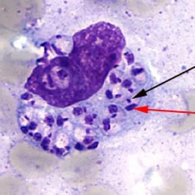 Microscopic view of tropical skin pathogens including Leishmania and microfilaria