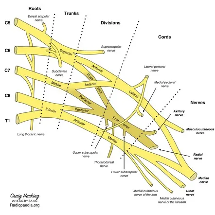 Brachial plexus anatomy showing nerve root organization