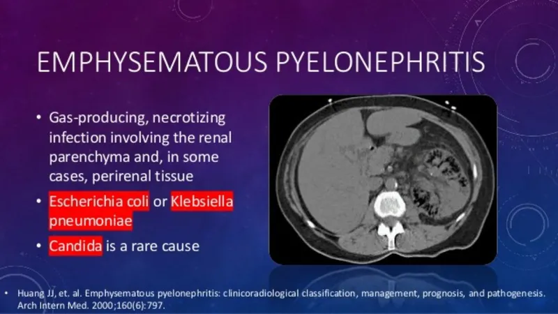 Figure 2: CT scan showing perinephric stranding and renal enlargement