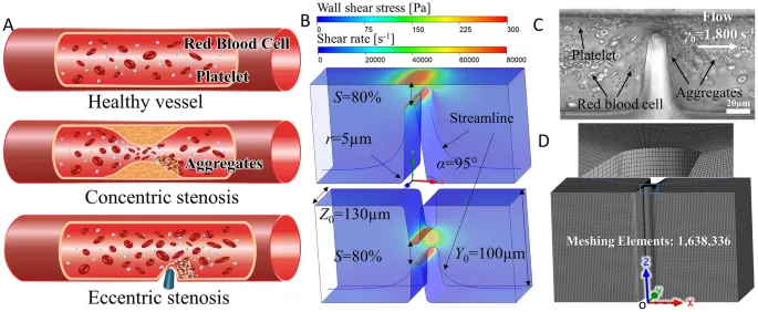 Hemodynamic flow patterns in normal and stenotic vessels