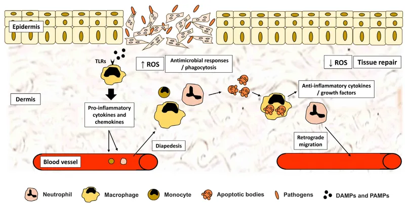 Detailed inflammatory cascade in wound healing showing neutrophil and macrophage recruitment