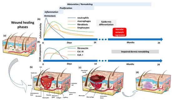 Comprehensive wound healing phases diagram showing hemostasis, inflammation, proliferation and remodeling