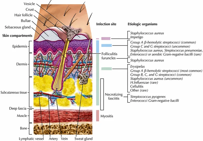 Skin infection depth and etiology
