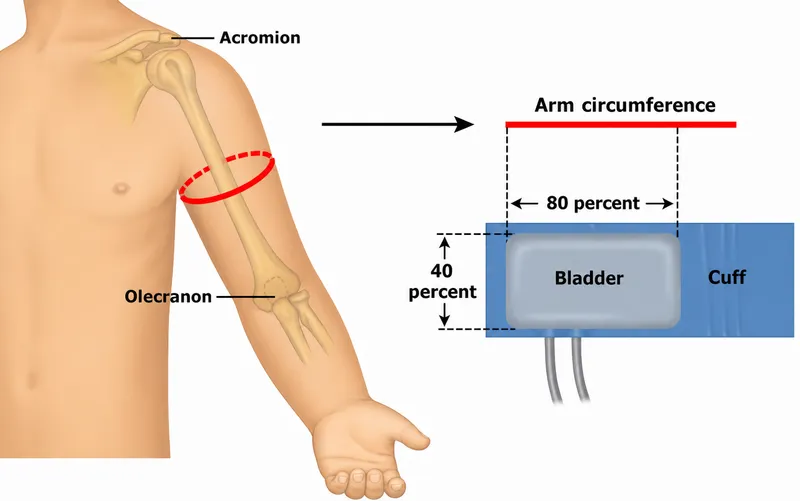 Pediatric Blood Pressure Cuff Size