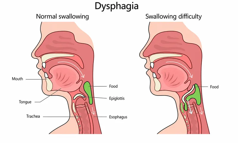 Anatomy of pharynx and esophagus