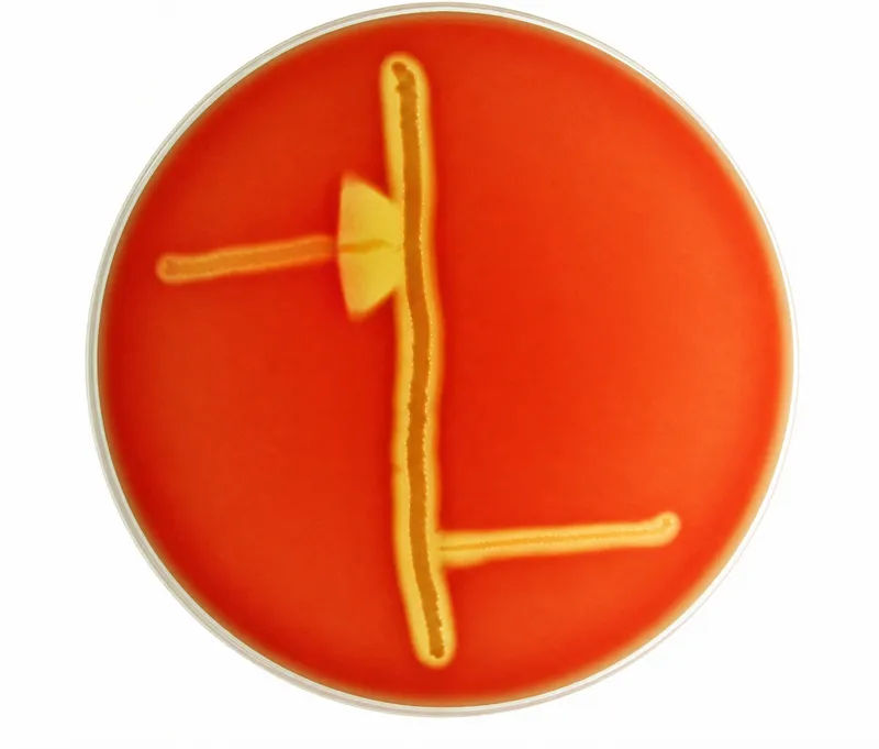 CAMP Test for GBS Identification
