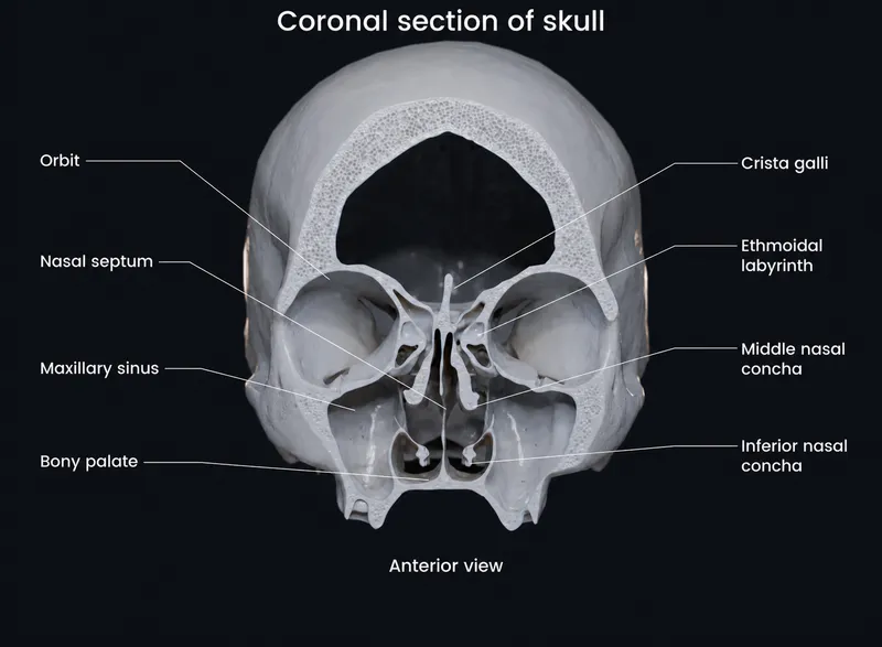 Coronal view of skull: Nasal cavity and paranasal sinuses