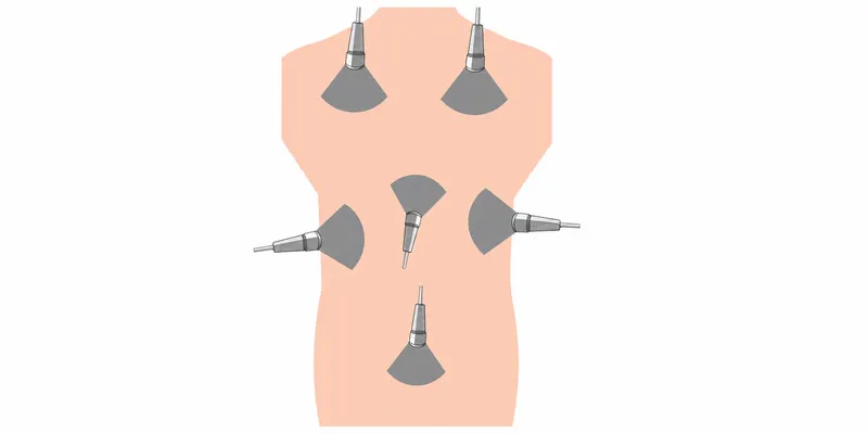 eFAST exam probe positions for trauma ultrasound