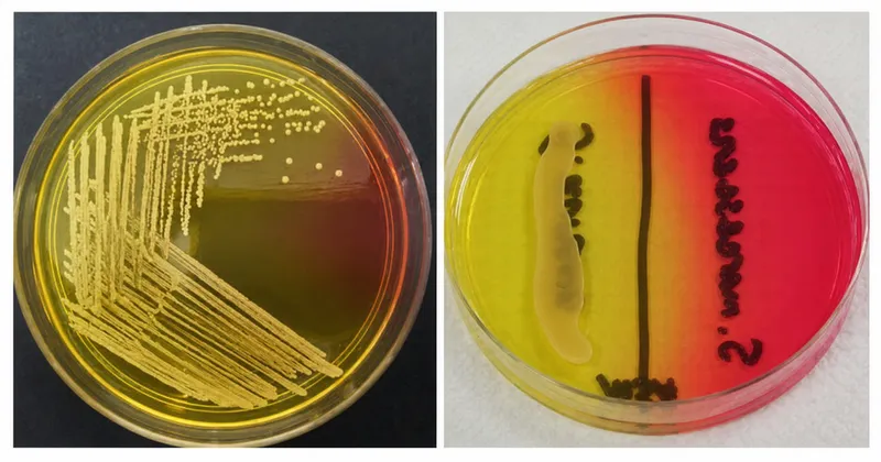 Mannitol salt agar showing Staphylococcus aureus growth