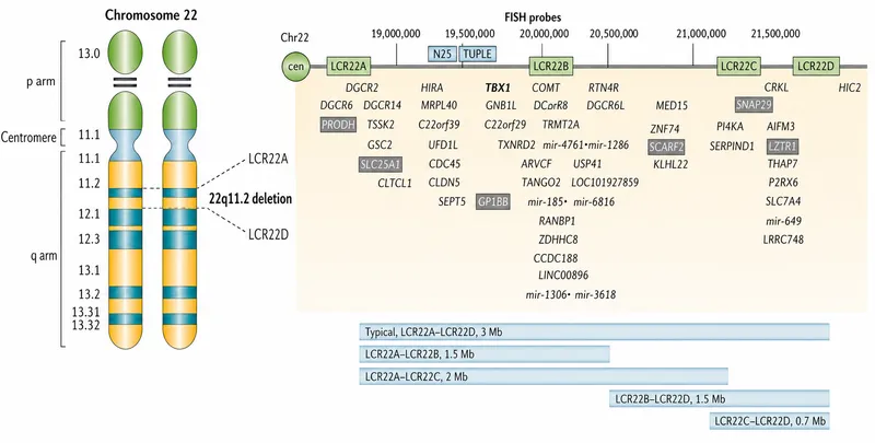 Chromosome 22q11.2 deletion