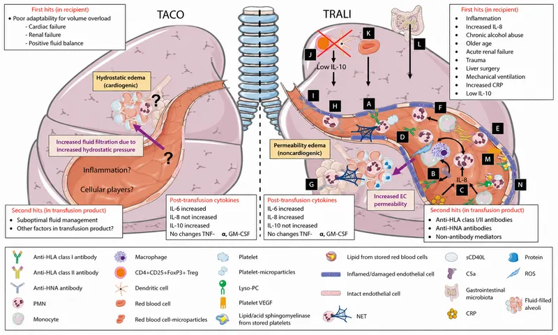 TRALI vs TACO Pathophysiology in Lung Alveoli