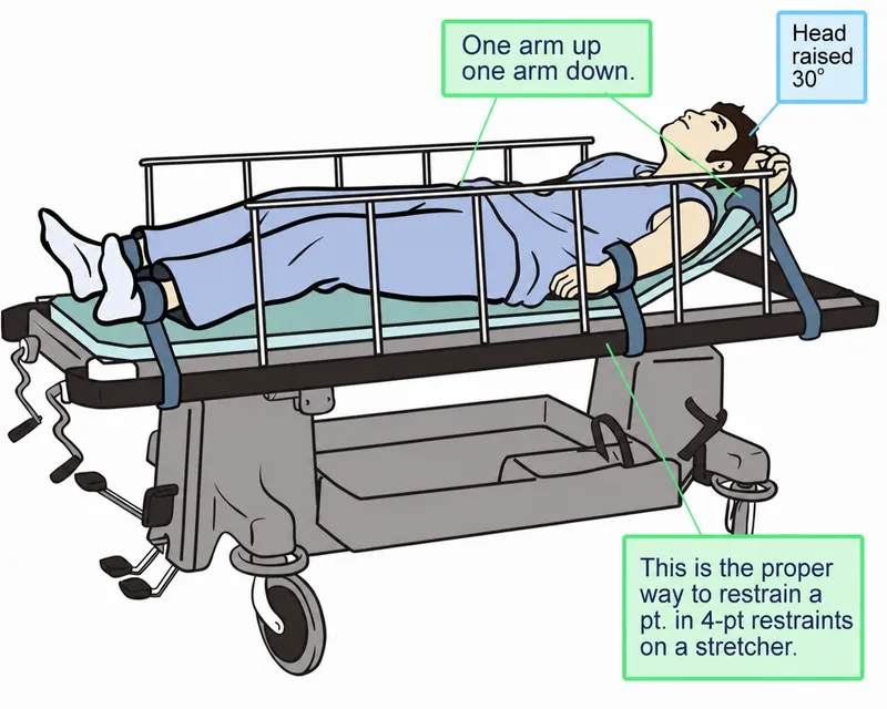 Proper 4-point restraint on stretcher