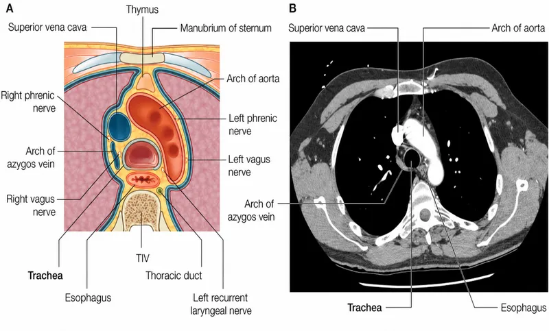 Cross-section of thorax: anatomy diagram and CT scan