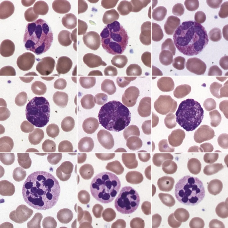 Granulocytes: Neutrophil, Eosinophil, Basophil