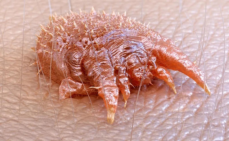 Scabies mite and Pediculosis louse