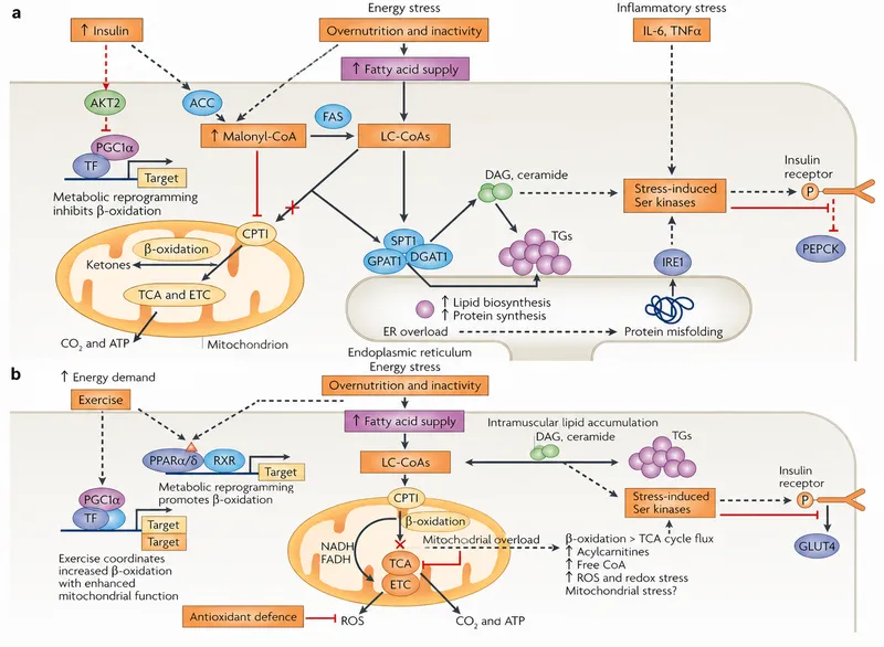 Cellular mechanisms of insulin resistance in type 2 diabetes